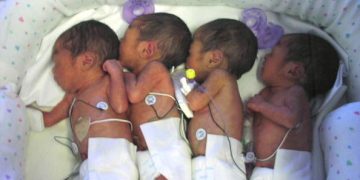402973 02: Newborn Quadruplets (L-R) Preana, Audreana, Natalie And Melody Were Born March 25, 2002 In Sacramento, Ca. The Largest Baby Weighing 2 Pounds, 8 Ounces And The Smallest Is 2 Pounds, 5 Ounces. Having Identical Quadruplets Is A One In 11 Million Event.  (Photo By Getty Images)