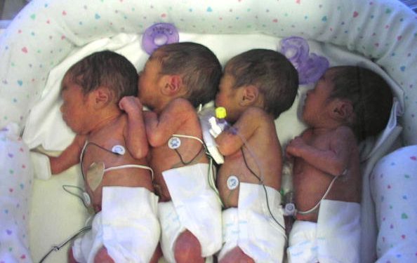 402973 02: Newborn Quadruplets (L-R) Preana, Audreana, Natalie And Melody Were Born March 25, 2002 In Sacramento, Ca. The Largest Baby Weighing 2 Pounds, 8 Ounces And The Smallest Is 2 Pounds, 5 Ounces. Having Identical Quadruplets Is A One In 11 Million Event.  (Photo By Getty Images)
